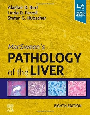 MacSweens Pathology of the Liver 8th edition