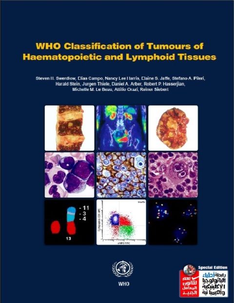 WHO Classification of Tumours of Haematopoietic and Lymphoid Tissues Revised Edition.