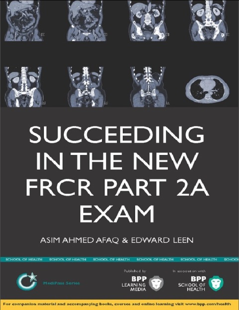 Succeeding in the New FRCR Part 2a Exam Single Best Answer (SBA) Revision Questions for Modules 1-6.