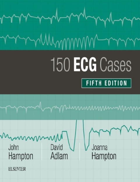 150 ECG Cases 5th Edition.
