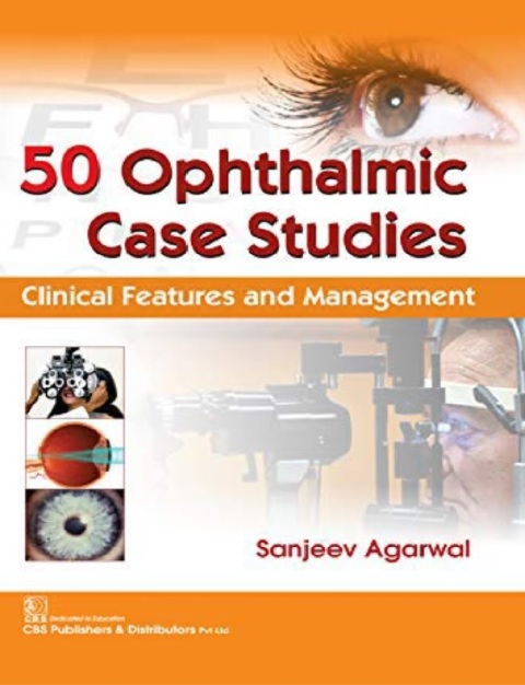 50 Ophthalmic Case Studies Clinical Features and Management