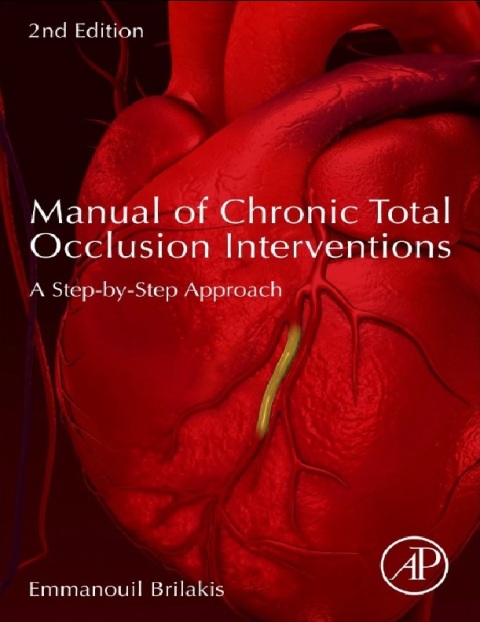 Manual of Chronic Total Occlusion Interventions A Step-by-Step Approach 2nd Edition.