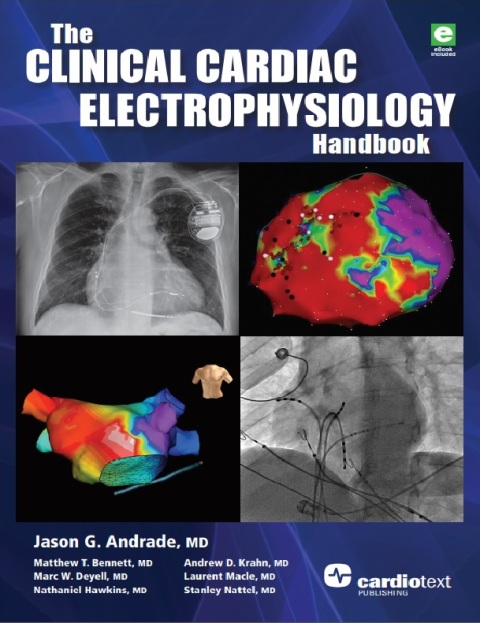 The Clinical Cardiac Electrophysiology Handbook 1st Edition.