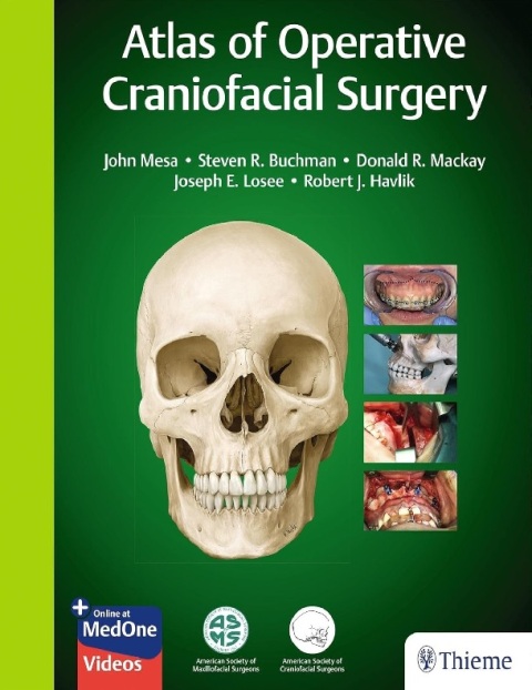 Atlas of Operative Craniofacial Surgery 1st Edition.