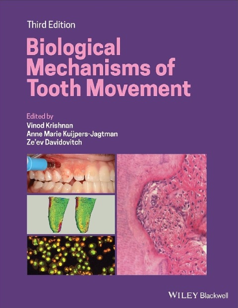 Biological Mechanisms of Tooth Movement.