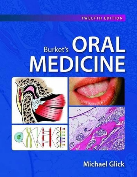 Burket's Oral Medicine 12th Edition.