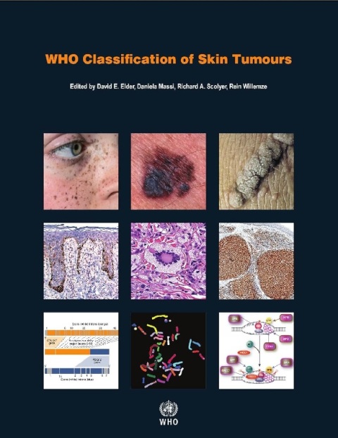 WHO Classification of Skin Tumours (WHO Classification of Tumours).